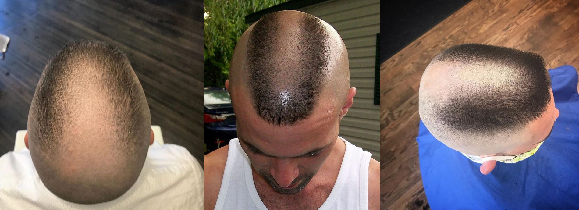 Men's horseshoe flat top haircut style